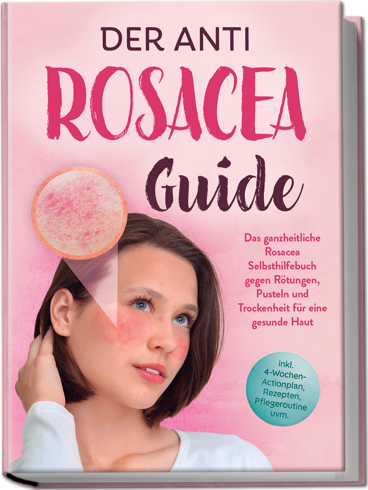 Der Anti Rosacea Guide: Das ganzheitliche Rosacea Selbsthilfebuch gegen Rötungen, Pusteln und Trockenheit für eine gesunde Haut - inkl. 4¿Wochen¿Actionplan, Rezepten, Pflegeroutine uvm. Leisure, Home & Garden