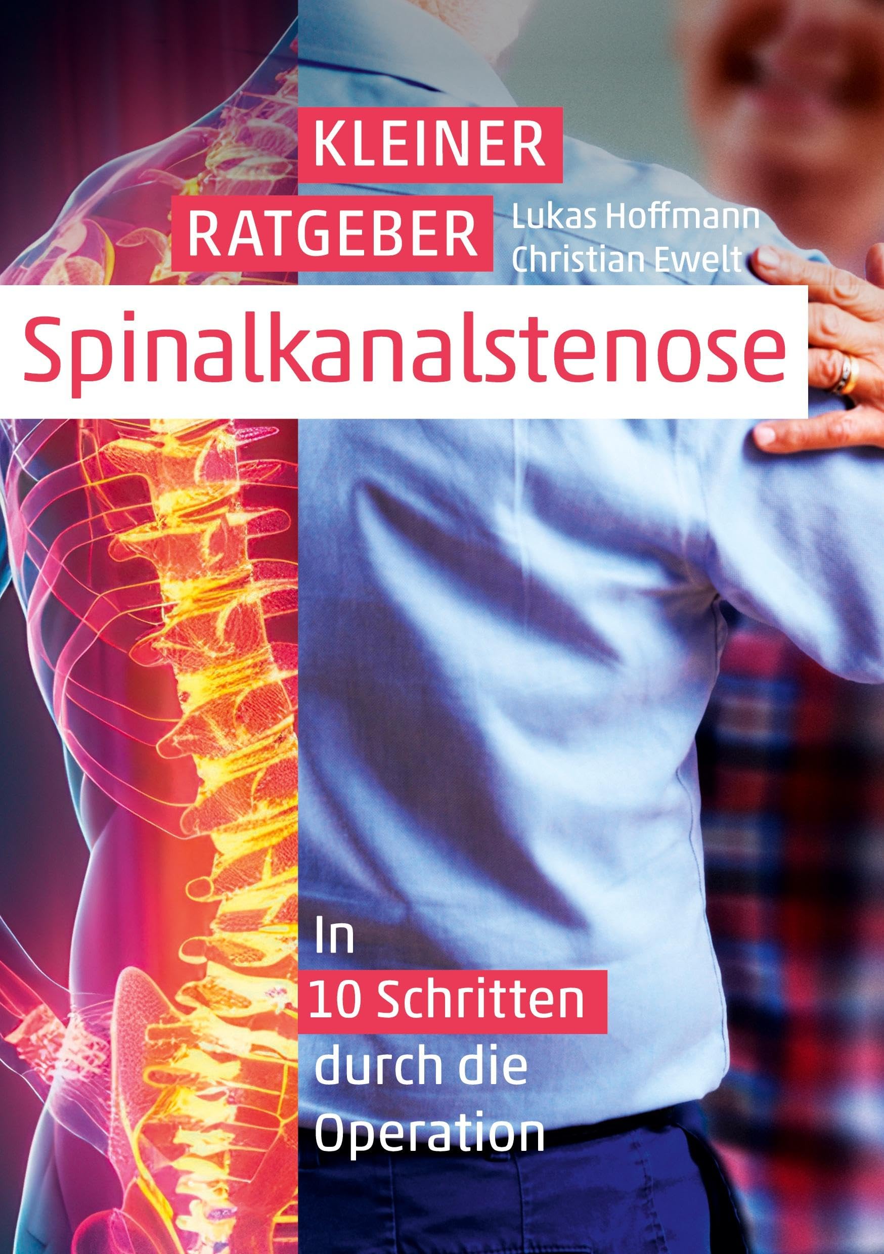 Kleiner Ratgeber Spinalkanalstenose: In 10 Schritten durch die Operation Medicine