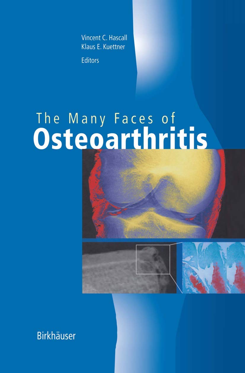 The Many Faces of Osteoarthritis Medicine