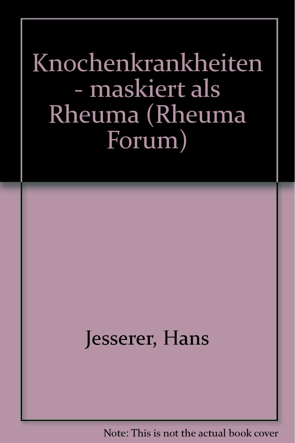 Rheuma-Forum / Knochenkrankheiten - maskiert als "Rheuma" Books