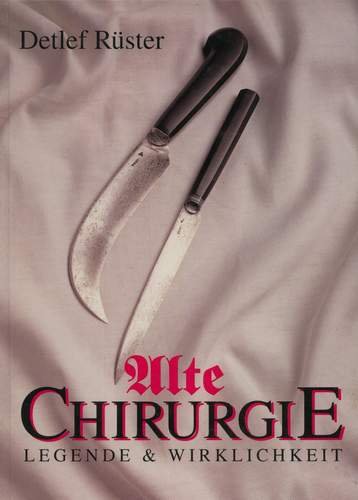 Alte Chirurgie: Legende und Wirklichkeit Medicine