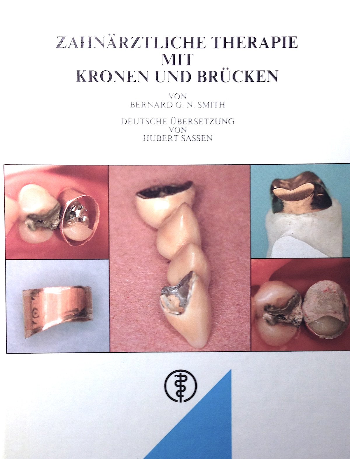 Zahnärztliche Therapie mit Kronen und Brücken Books