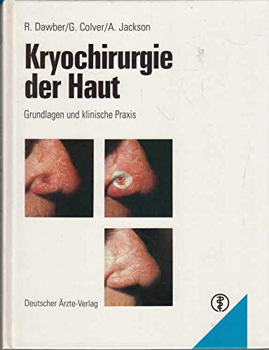 Kryochirurgie der Haut: Grundlagen und klinische Praxis Professional & Reference Books
