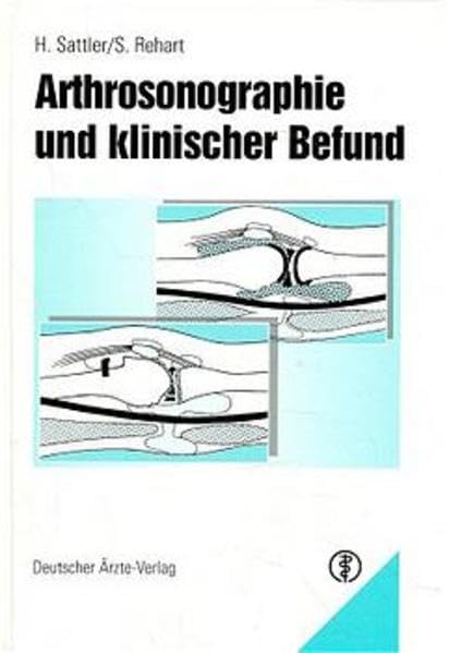 Arthrosonographie und klinischer Befund book