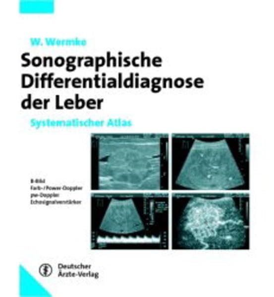 Sonographische Differenzialdiagnose Leberkrankheiten: Systematischer Atlas Medicine