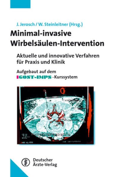 Minimalinvasive Wirbelsäulen-Intervention: Aktuelle und innovative Verfahren für Praxis und Klinik Aufgebaut auf dem IGOST-IMPS-Kurssystem Medicine