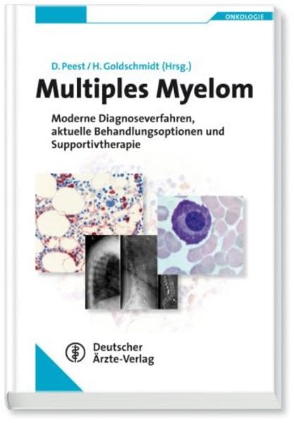 Multiples Myelom: Moderne Diagnoseverfahren, aktuelle Behandlungsoptionen und Supportivtherapie (Reihe Onkologie) Medicine