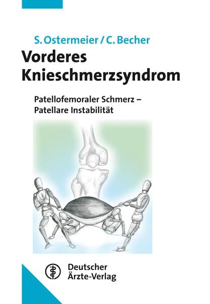 Das vordere Knieschmerzsyndrom Medicine