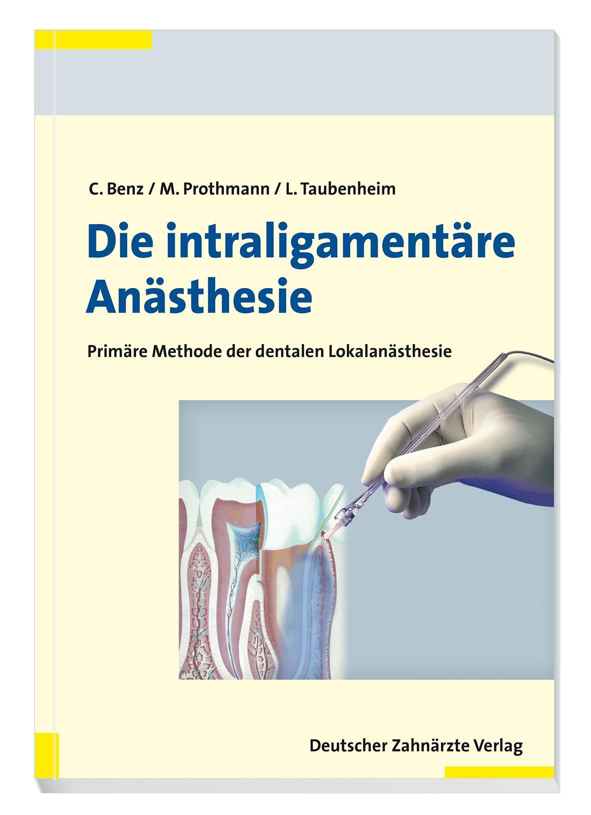 Die intraligamentäre Anästhesie Medicine