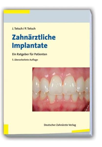 Zahnärztliche Implantate Medicine