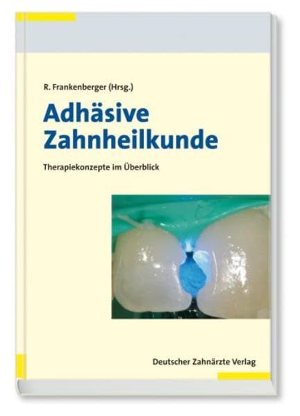 Adhäsive Zahnheilkunde: Wissenschaft und Praxis Medicine