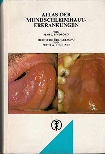 Atlas der Mundschleimhaut-Erkrankungen Medicine