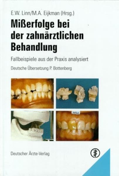 Misserfolge bei der zahnärztlichen Behandlung: Fallbeispiele aus der Praxis analysiert Books