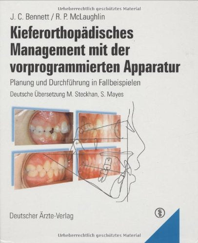 Kieferorthopädisches Management mit der vorprogrammierten Apparatur: Planung und Durchführung in Fallbeispielen Medicine
