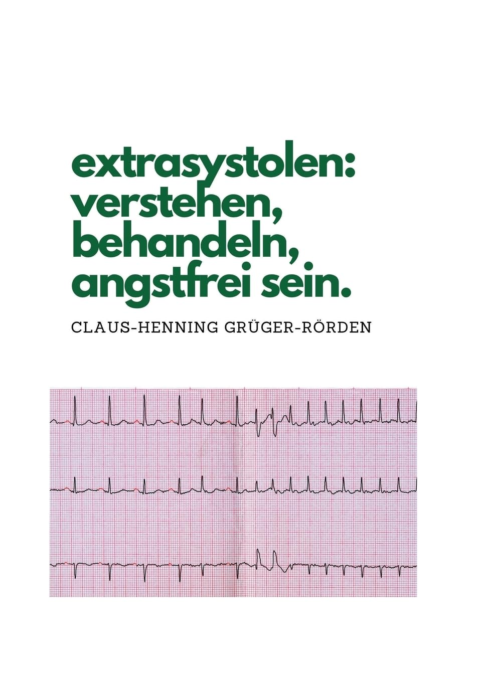 extrasystolen: verstehen, behandeln, angstfrei sein. Health, Nutrition & Fitness