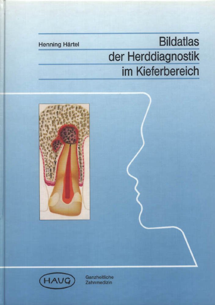 Bildatlas der Herddiagnostik im Kieferbereich Medicine