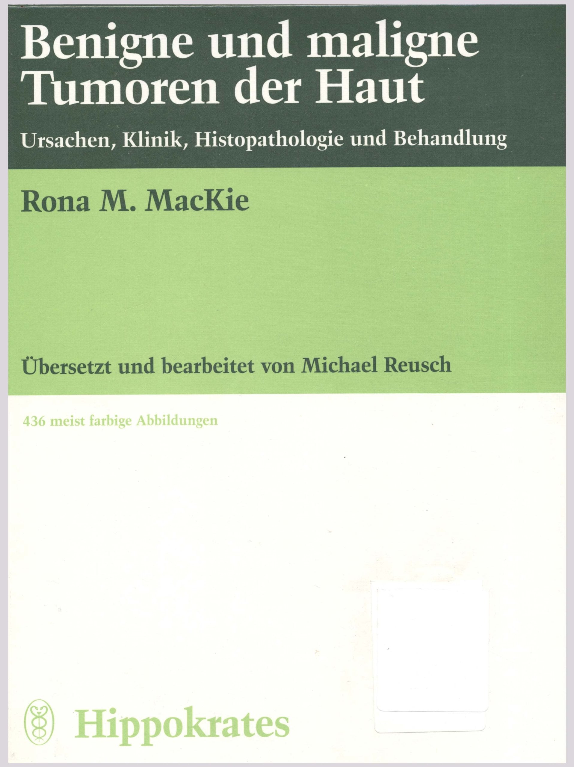 Benigne und maligne Tumoren der Haut. Ursachen, Klinik, Histopathologie und Behandlung Health, Nutrition & Fitness
