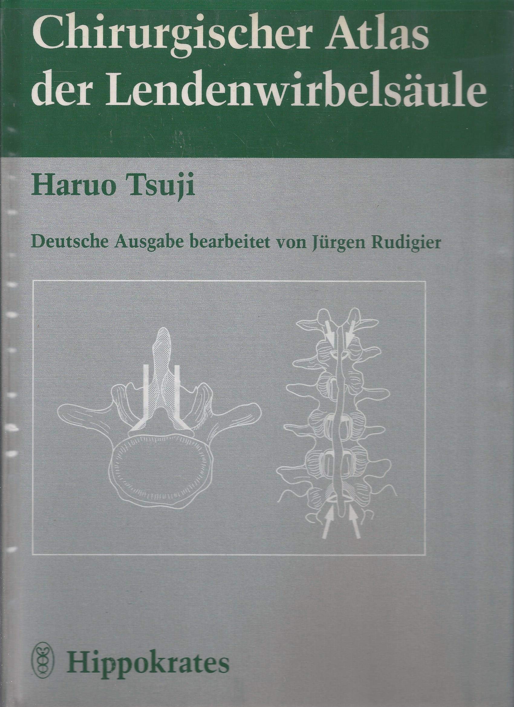 Chirurgischer Atlas der Lendenwirbelsäule Medicine Books