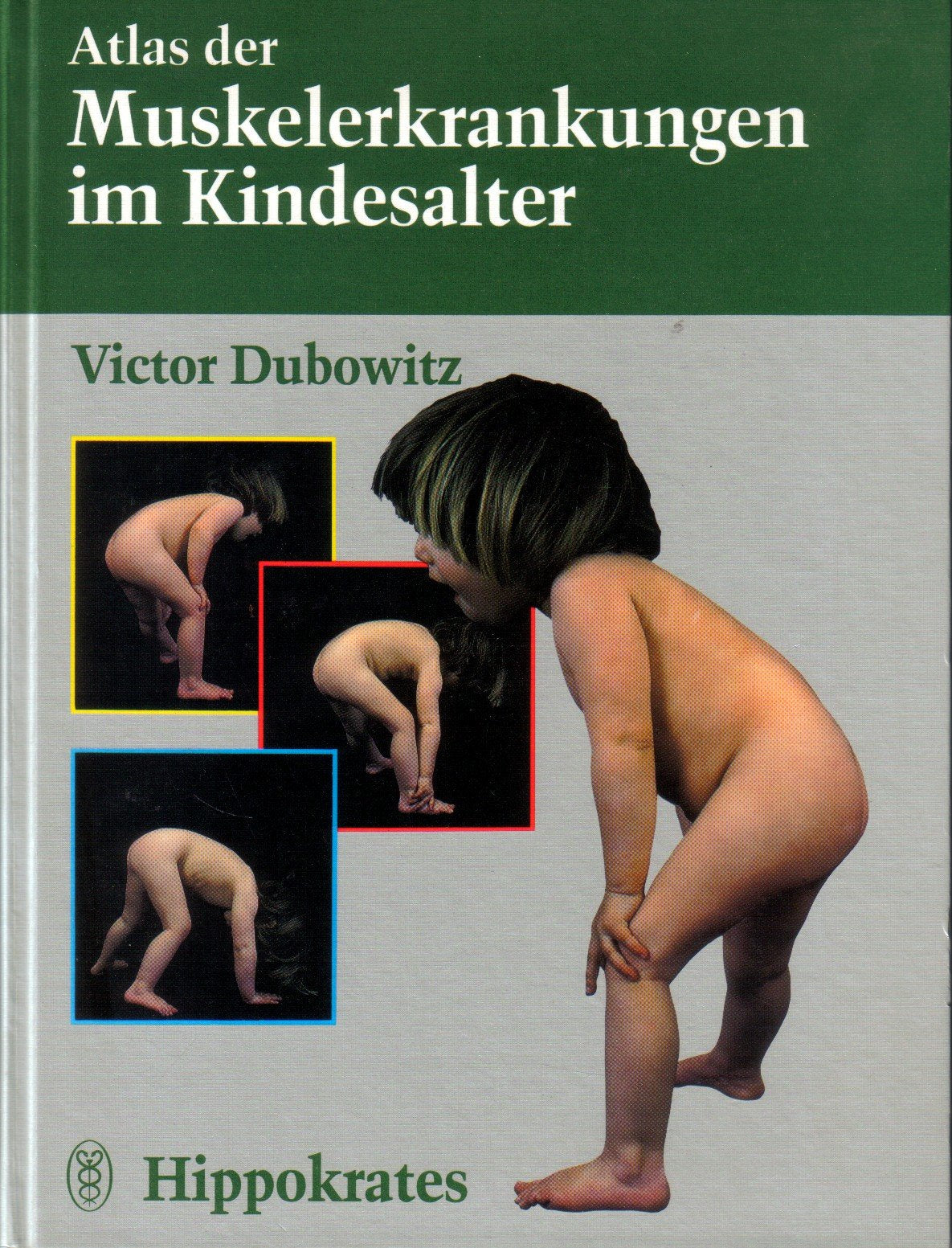 Atlas der Muskelerkrankungen im Kindesalter Medicine