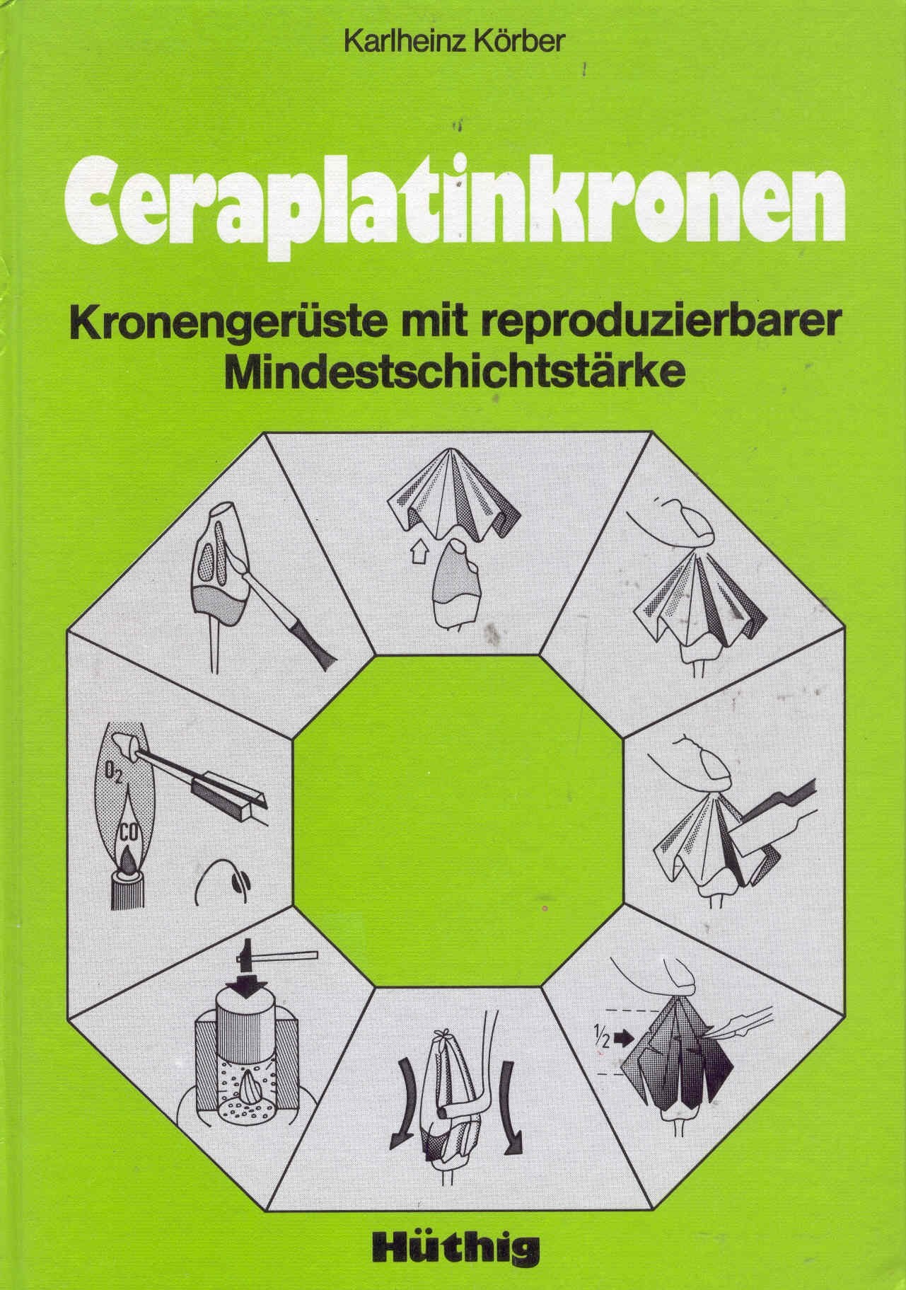Ceraplatinkronen. Kronengerüste mit reproduzierbarer Mindestschichtstärke Books