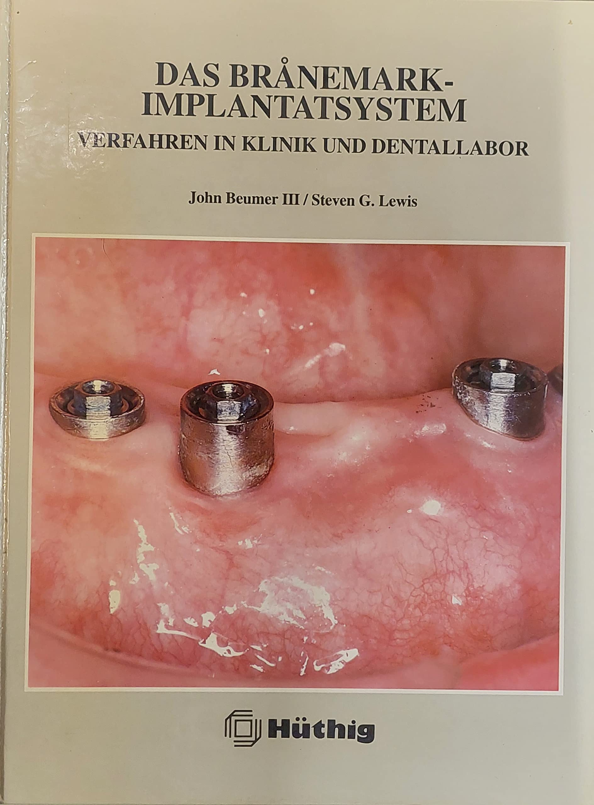 Das Brånemark-Implantatsystem. Verfahren in Klinik und Labor Law