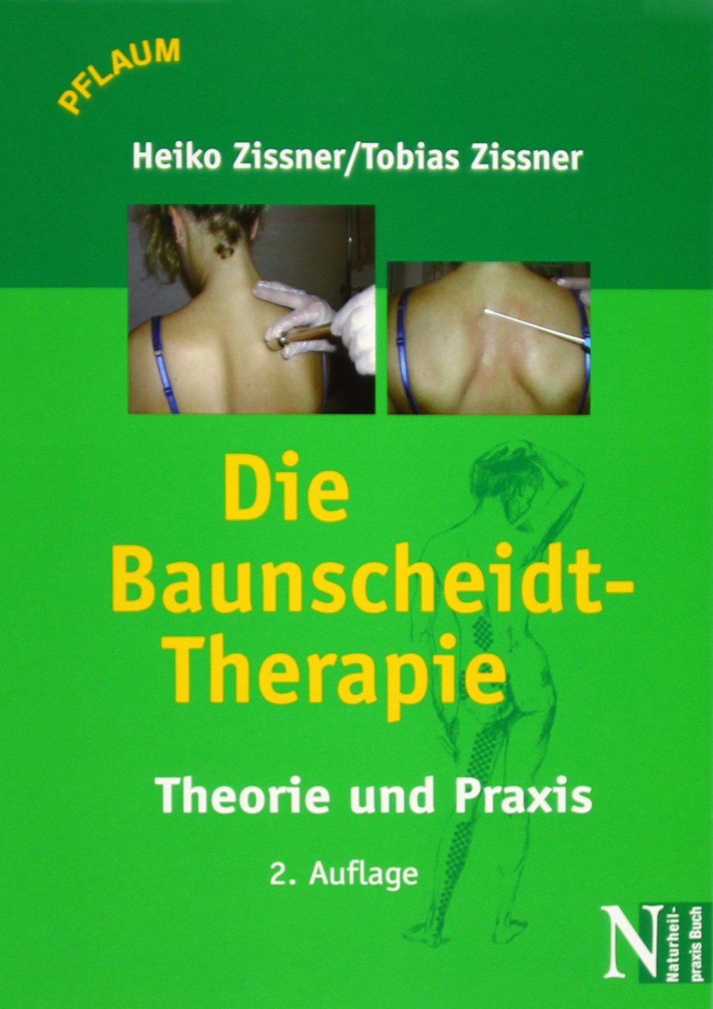 Die Baunscheidt-Therapie: Theorie und Praxis Medicine