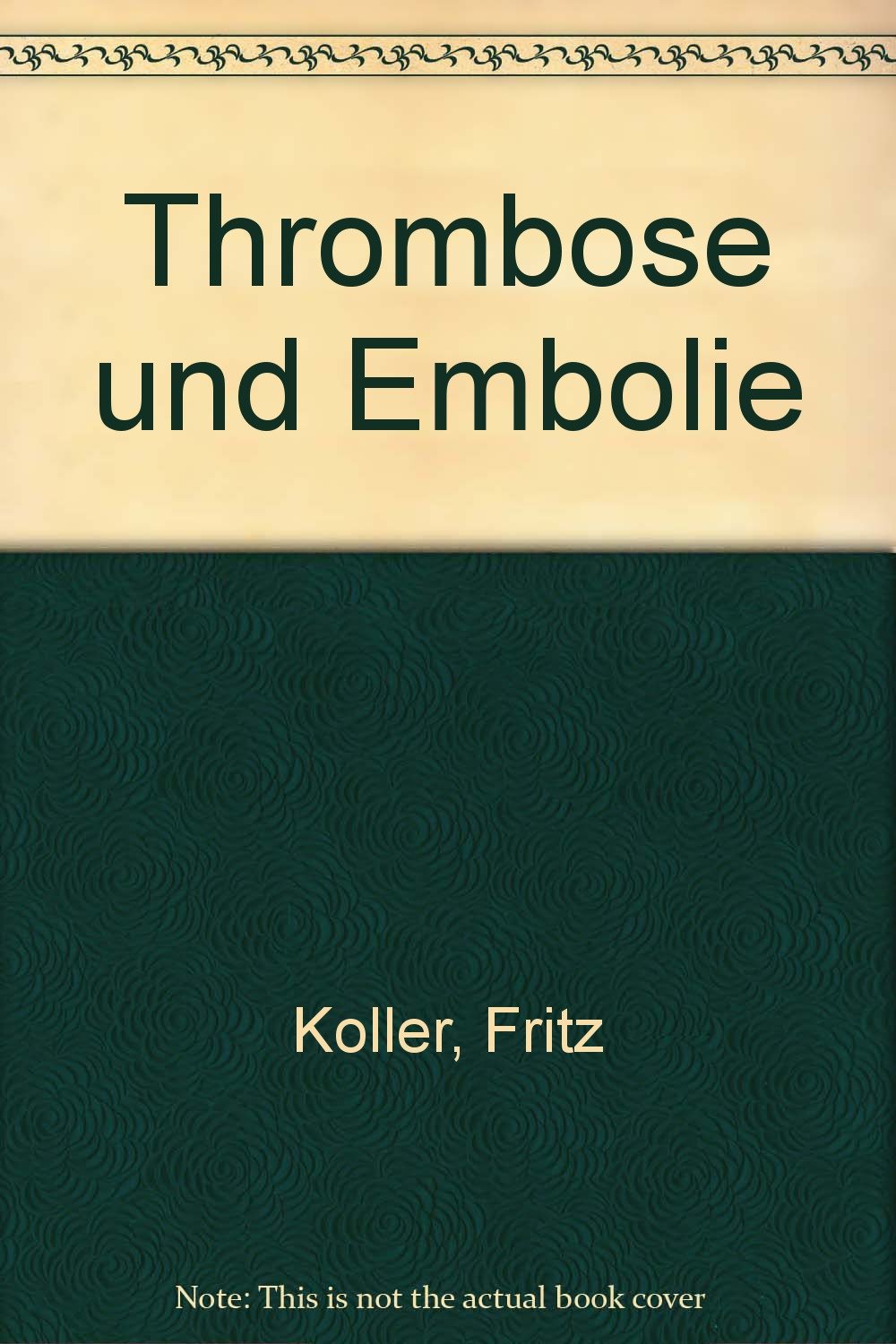 Thrombose und Embolie: Arterielle und venöse Gefässverschlüsse in Innerer Medizin, Chirurgie, Frauenheilkunde und Neurologie mit Einschluss der ... Embolien sowie der intravasculären Gerinnung Medicine