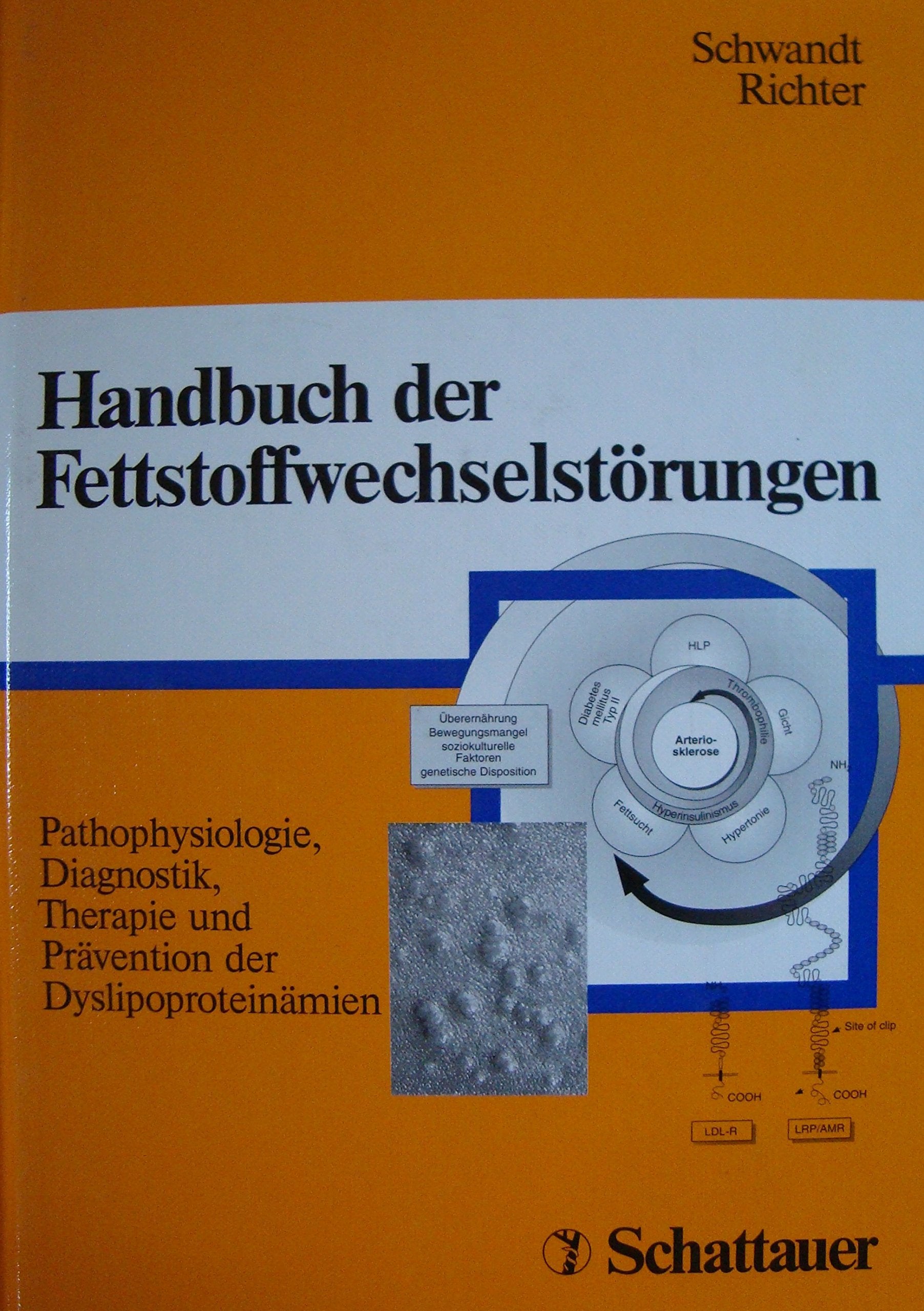 Handbuch der Fettstoffwechselstörungen: Pathophysiologie, Diagnostik, Therapie, Prävention der Dyslipoproteinämien book