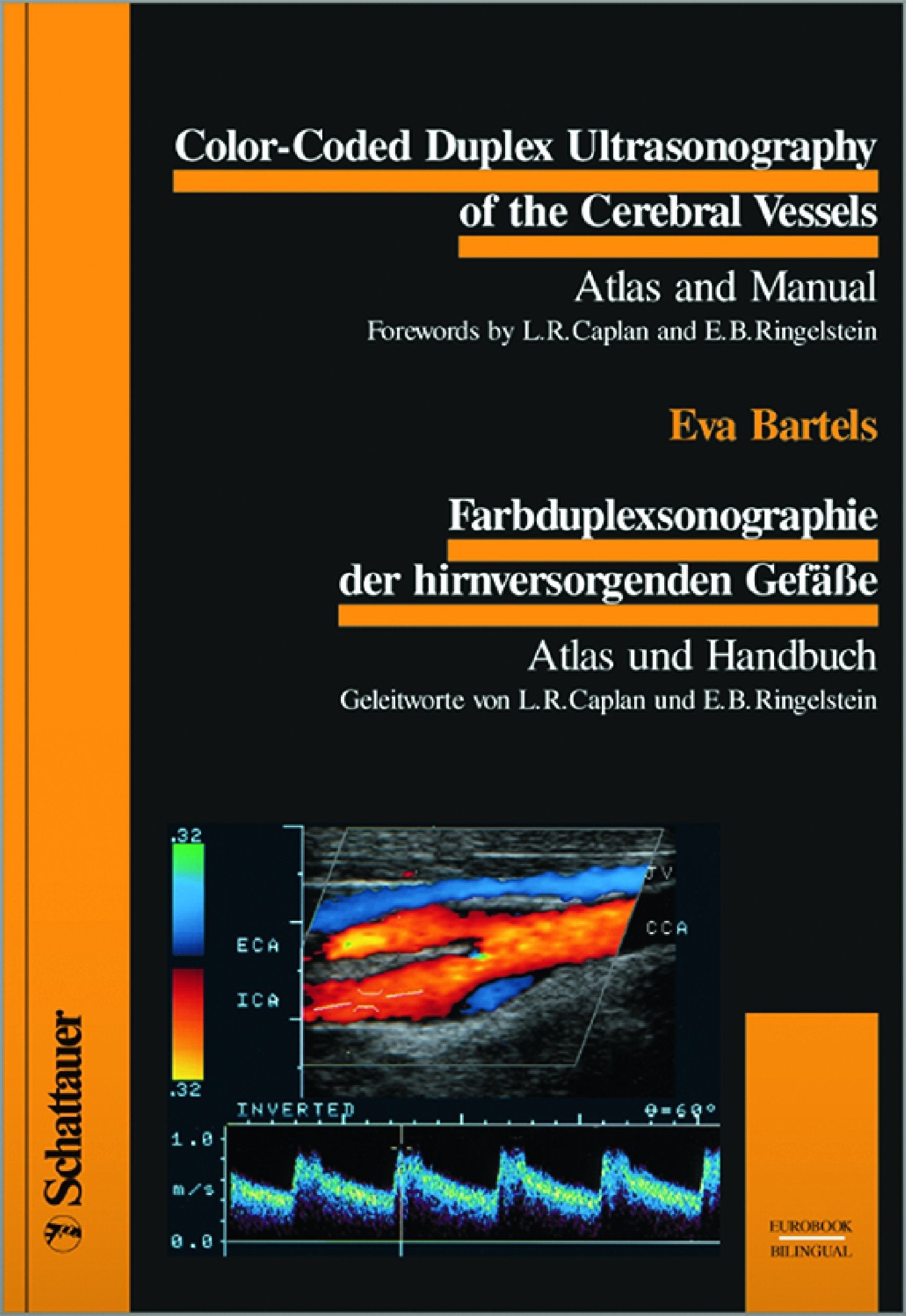 Color-Coded Duplex Ultrasonography of the Cerebral Vessels. Farbduplexsonographie der hirnversorgenden Gefässe: Atlas and Manual. Atlas und Handbuch. ... Handbuch. Dtsch.-Engl. (Bilingual/Eurobooks) Medicine