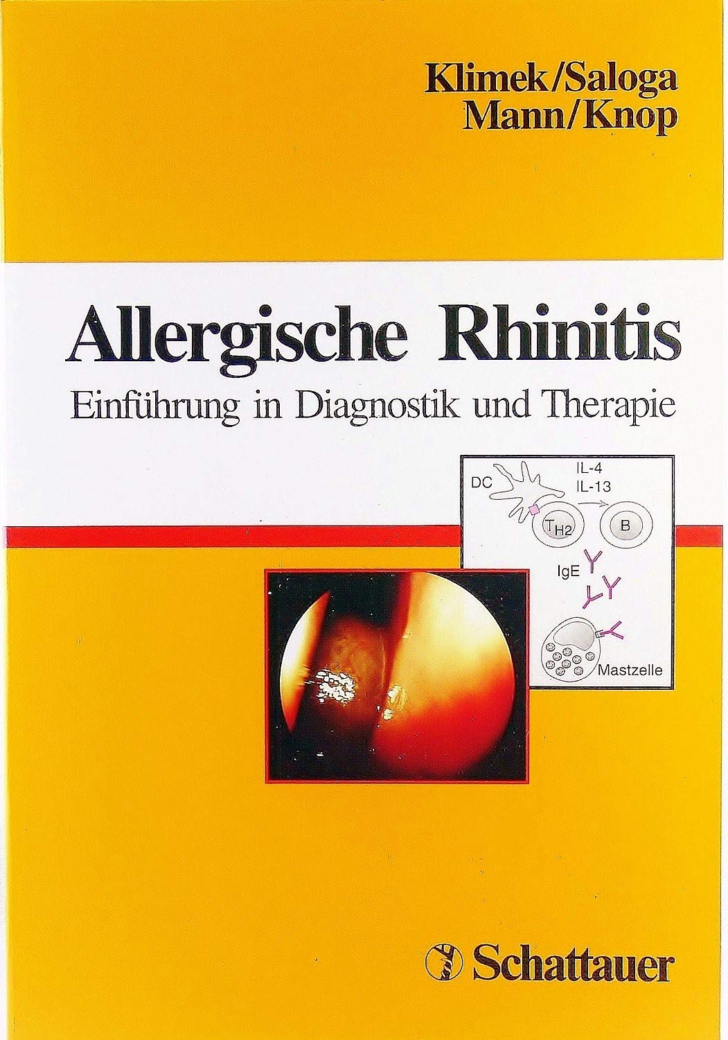 Allergische Rhinitis: Einführung in Diagnostik und Therapie Medicine