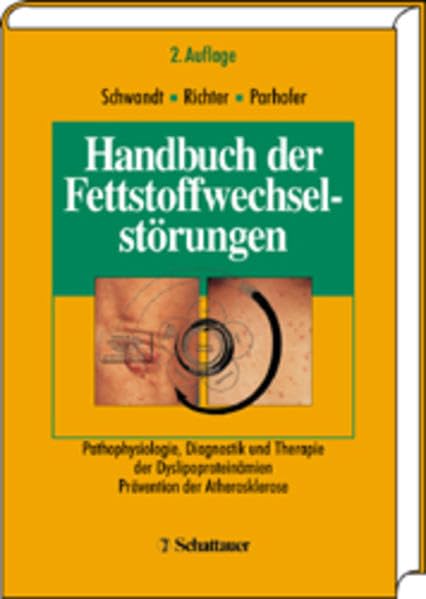 Handbuch der Fettstoffwechselstörungen: Pathophysiologie, Diagnostik, Therapie und Prävention der Dyslipoproteinämien - Prävention der Atherosklerose Natural Sciences