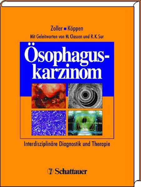 Ösophaguskarzinom: Interdisziplinäre Diagnostik und Therapie Medicine