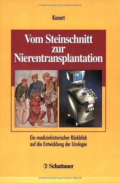 Vom Steinschnitt zur Nierentransplantation. Ein medizinhistorischer Rückblick auf die Entwicklung der Urologie. Medicine