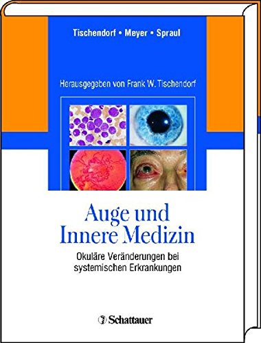 Auge und Innere Medizin: Okuläre Veränderungen bei systemischen Erkankungen Medicine