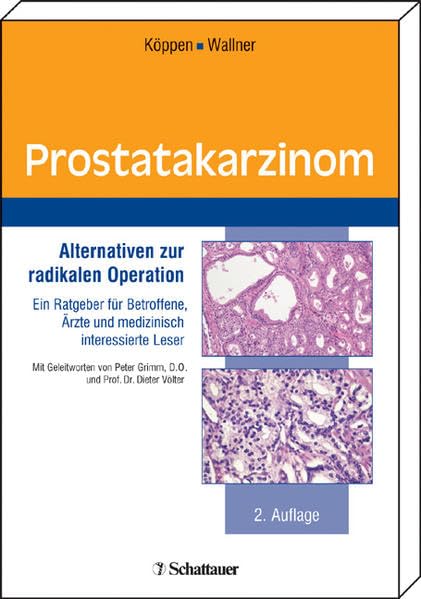 Prostatakarzinom: Alternativen zur radikalen Operation. Ein Ratgeber für Betroffene, Ärzte und medizinisch interessierte Leser Medicine