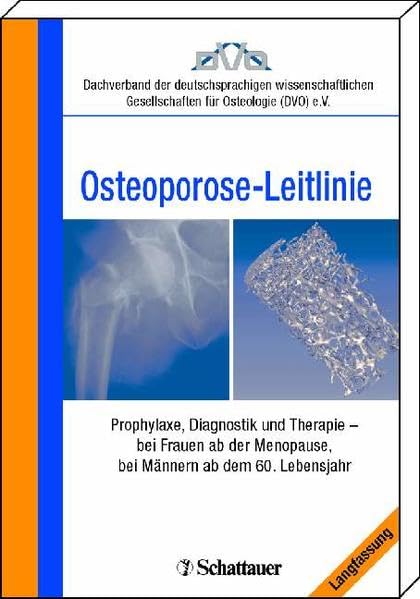Evidenzbasierte Konsensus-Leitlinie zur Osteoporose Medicine