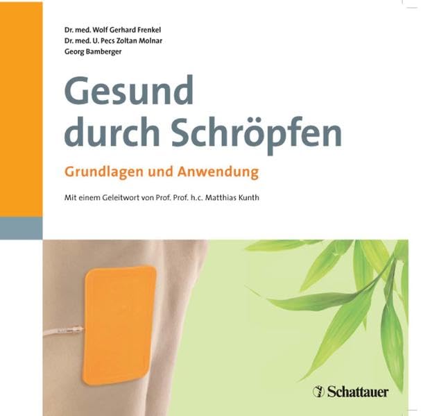 Gesund durch Schröpfen: Grundlagen und Anwendung: Grundlagen und Anwendung. Vorw. v. Matthias Kunth Medicine