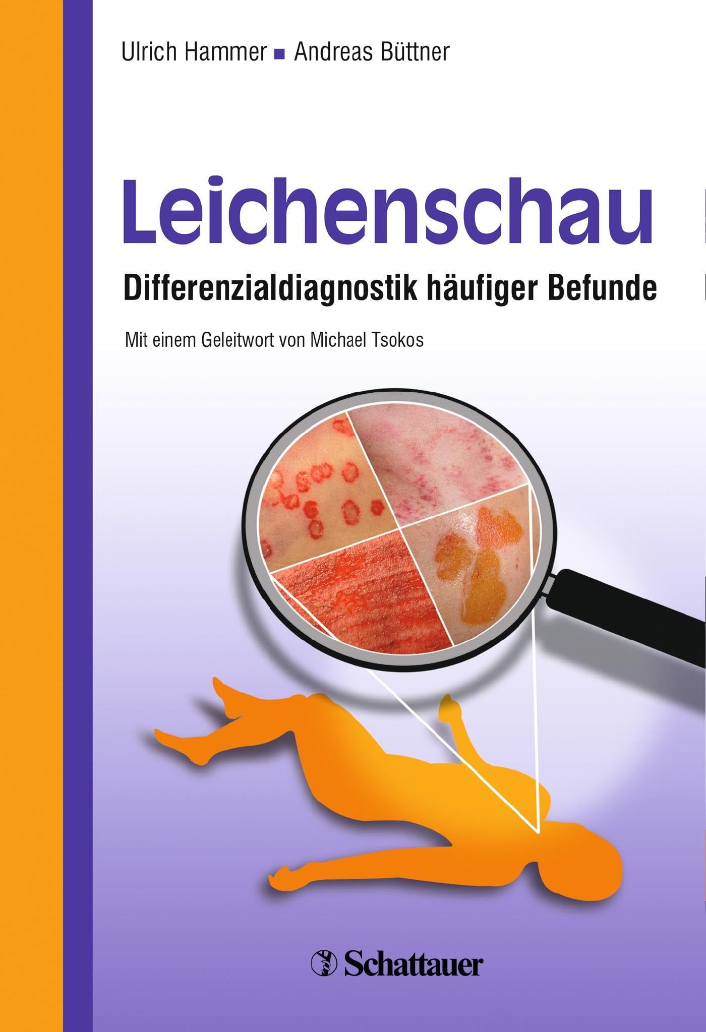 Leichenschau: Differenzialdiagnostik häufiger Befunde Medicine