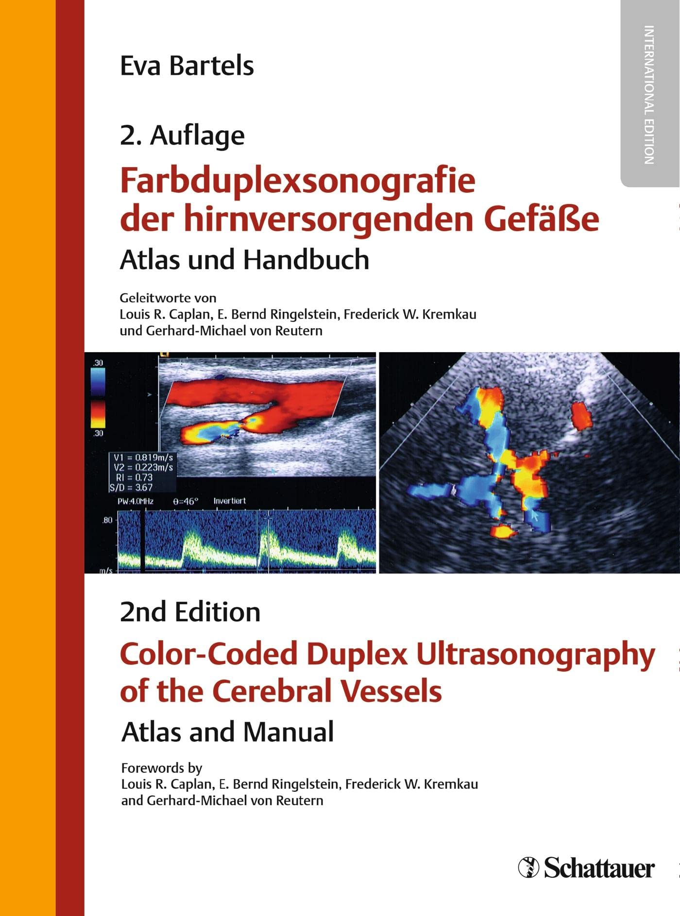 Farbduplexsonografie: Atlas and Manual // Atlas und Handbuch // INTERNATIONAL EDITION Medicine