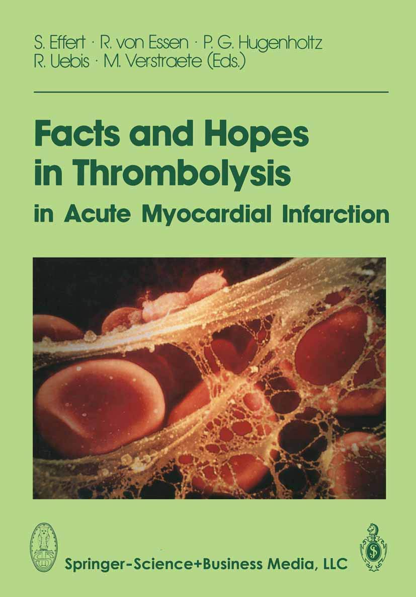 Facts and Hopes in Thrombolysis in Acute Myocardial Infarction Medicine