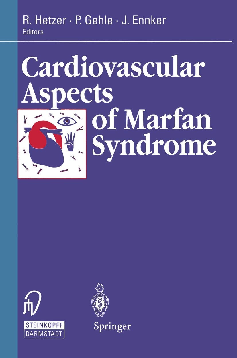 Cardiovascular Aspects of Marfan Syndrome Medicine