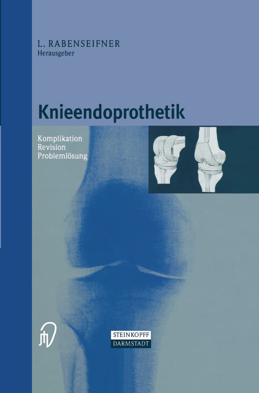 Knieendoprothetik. Komplikation - Revision - Problemlösung Medicine