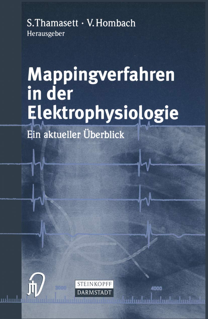 Mappingverfahren in der Elektrophysiologie. Ein aktueller Überblick Medicine