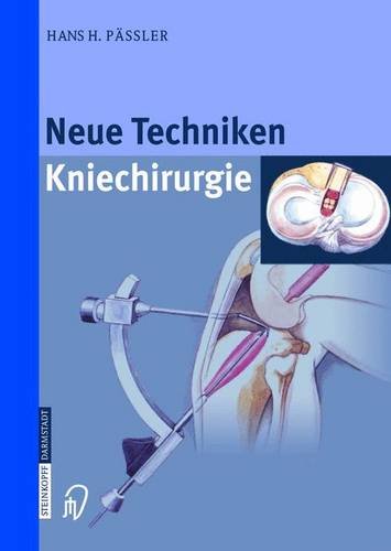 Product Image: Neue Techniken - Kniechirurgie