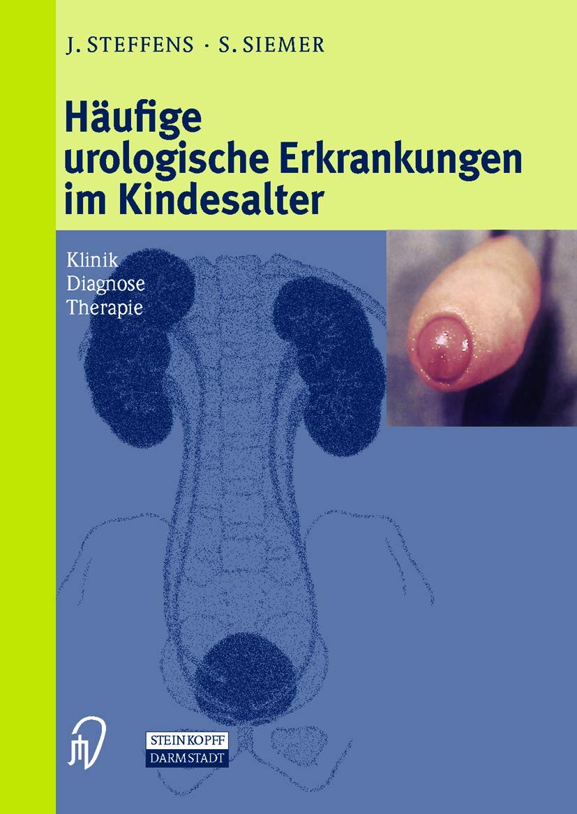 Häufige urologische Erkrankungen im Kindesalter Medicine