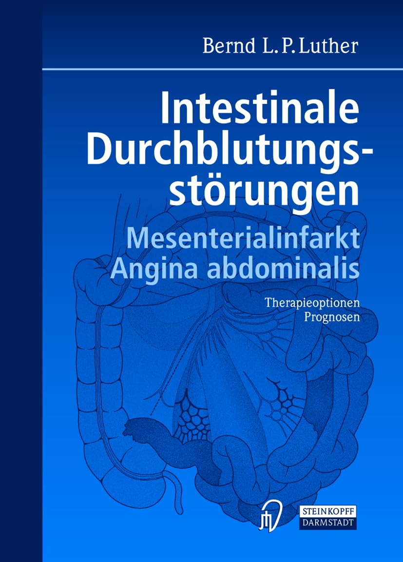 Intestinale Durchblutungsstörungen. Mesenterialinfarkt. Angina abdominalis. Therapieoptionen. Prognosen. Medicine