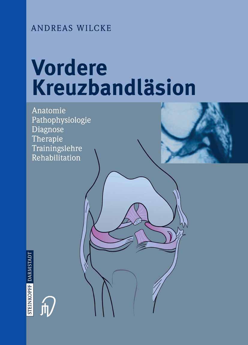 Vordere Kreuzbandläsion Medicine