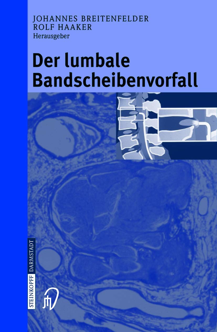 Der lumbale Bandscheibenvorfall Medicine Books