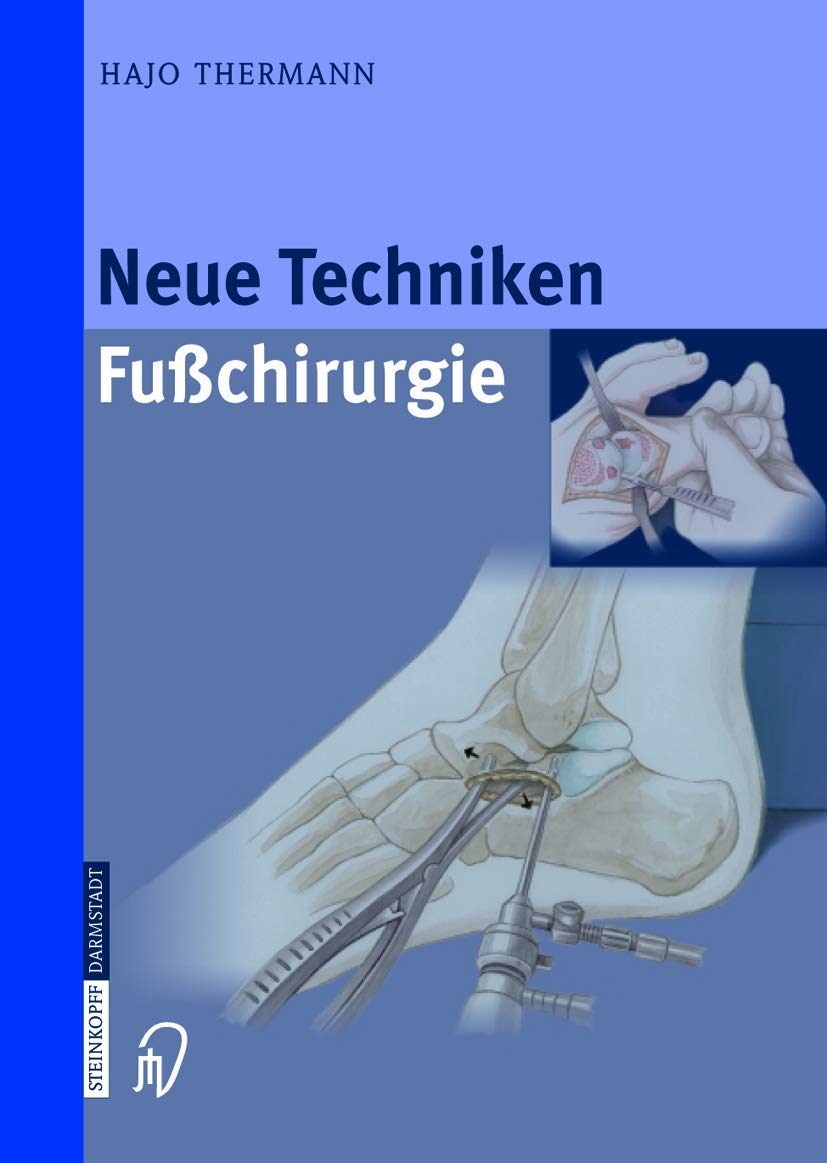 Neue Techniken Fusschirurgie Medicine