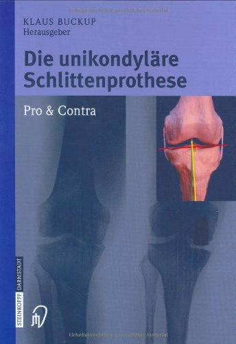 Die unikondyläre Schlittenprothese: Pro & Contra Medicine